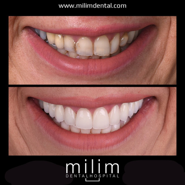 Slider image (10) Milim Dental